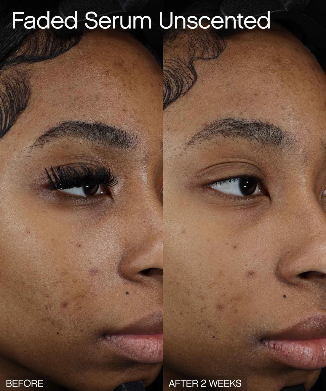 BRIGHTENING & CLEARING SERUM - 50ML