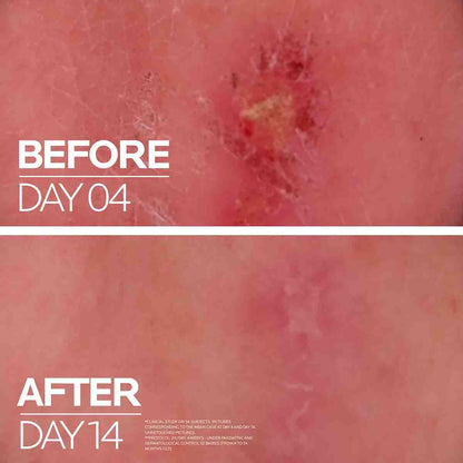 LA ROCHE-POSAY - CICAPLAST BAUME B5+ ULTRA